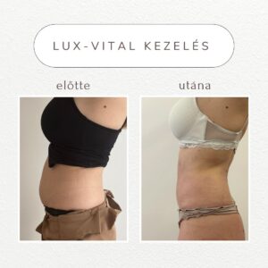 vital-shape-luxvital-referencia