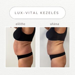 vital-shape-luxvital-referencia