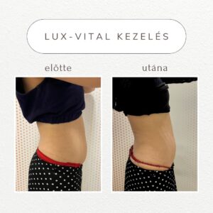 vital-shape-luxvital-referencia
