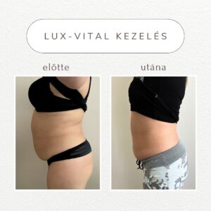 vital-shape-luxvital-referencia