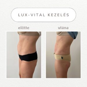 vital-shape-luxvital-referencia
