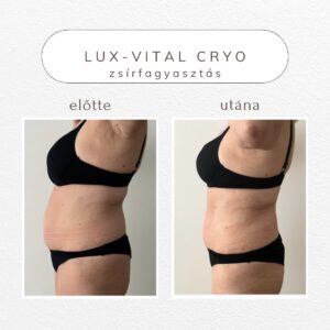 vital-shape-cryo-referencia