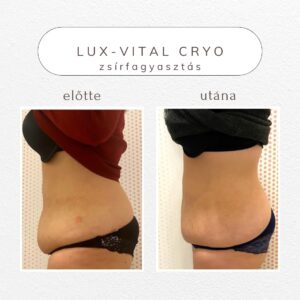 vital-shape-cryo-referencia