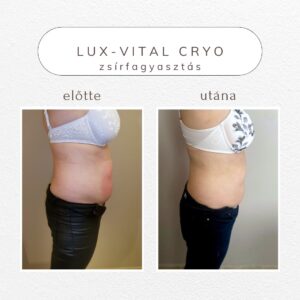 vital-shape-cryo-referencia
