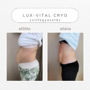 vital-shape-cryo-referencia